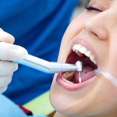 Medical scene of cute young woman at the dentist.